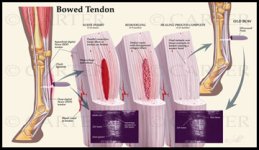 2A-7b-tendon.jpg